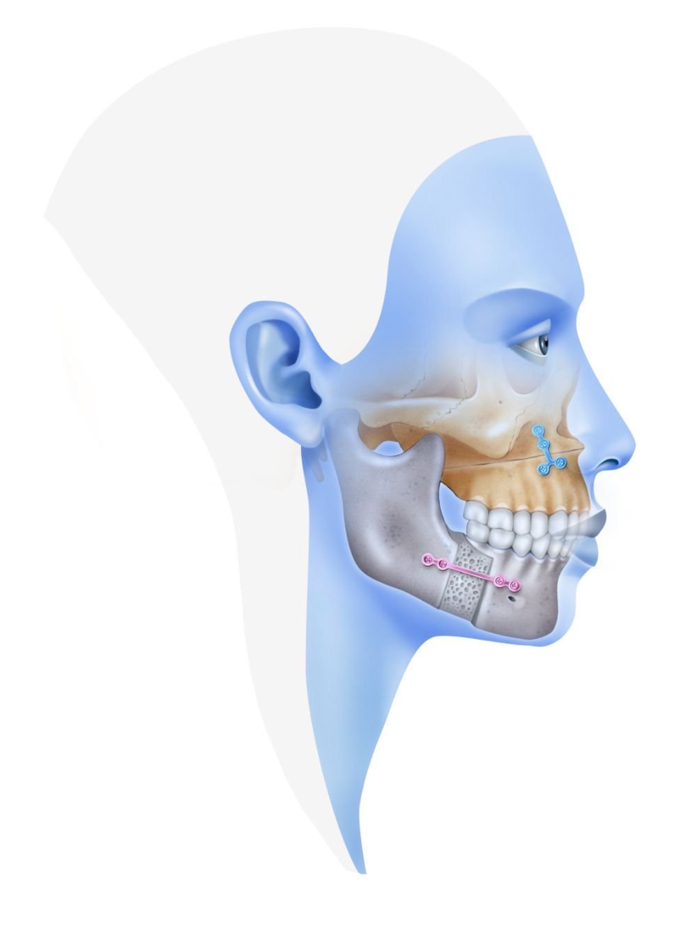 Oral and Maxillofacial surgery